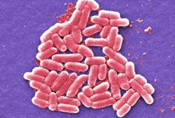 A colorized scanning electron micrograph image made in 2006 shows the O157:H7 strain of the E. coli bacteria.