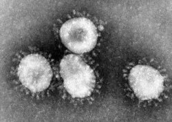 Corona virus 2019-nCOV